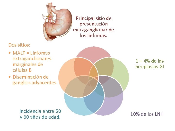 Principal sitio de presentación extraganglionar de los linfomas. Dos sitios: • MALT = Linfomas