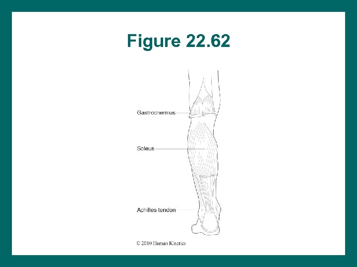 Figure 22. 62 