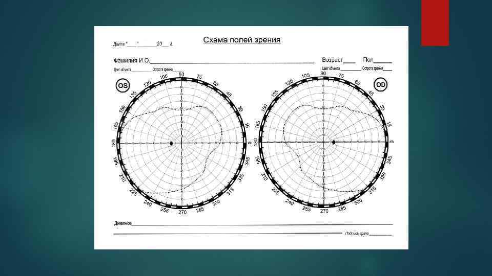 Поля зрения схема бланк