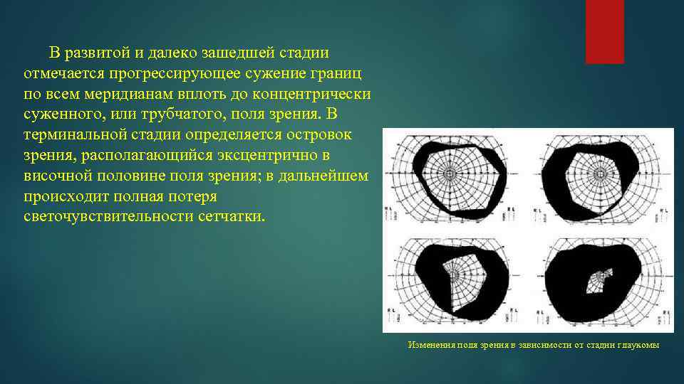 В развитой и далеко зашедшей стадии отмечается прогрессирующее сужение границ по всем меридианам вплоть