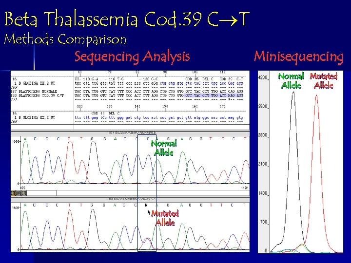 Beta Thalassemia Cod. 39 C T Methods Comparison Sequencing Analysis Minisequencing Normal Mutated Allele