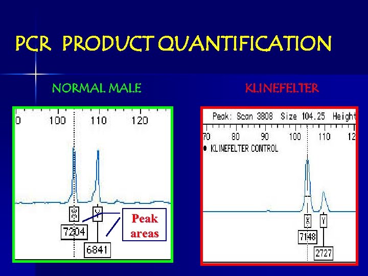 PCR PRODUCT QUANTIFICATION NORMAL MALE Peak areas KLINEFELTER 