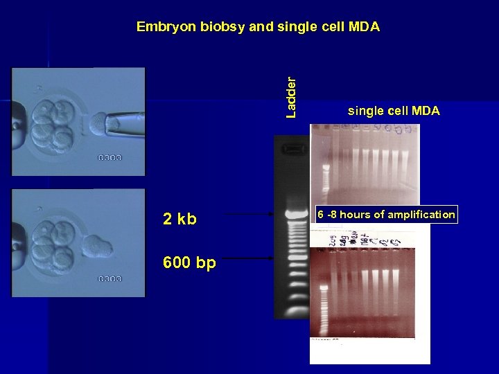 Ladder Embryon biobsy and single cell MDA 2 kb 600 bp single cell MDA