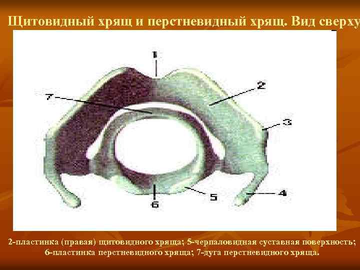 Щитовидный хрящ и перстневидный хрящ. Вид сверху 2 -пластинка (правая) щитовидного хряща; 5 -черпаловидная