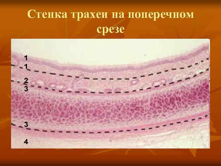 Стенка трахеи на поперечном срезе 