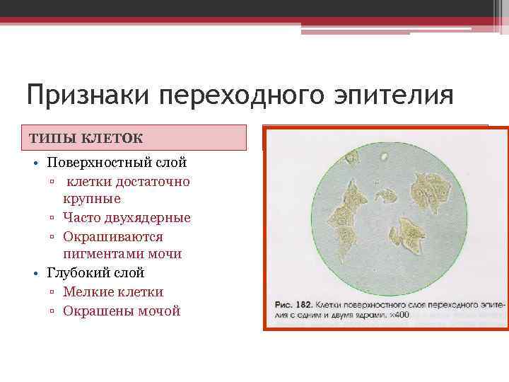 Признаки переходного эпителия ТИПЫ КЛЕТОК • Поверхностный слой ▫ клетки достаточно крупные ▫ Часто