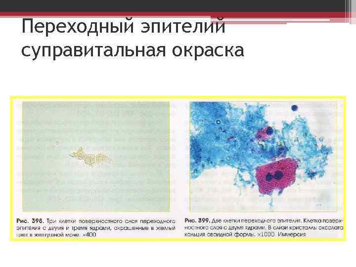 Переходный эпителий суправитальная окраска 