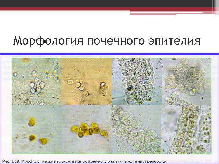 Микроскопия осадка мочи фото с описанием