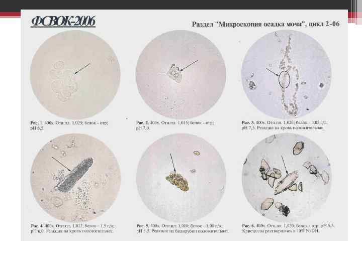 Микроскопия осадка норма