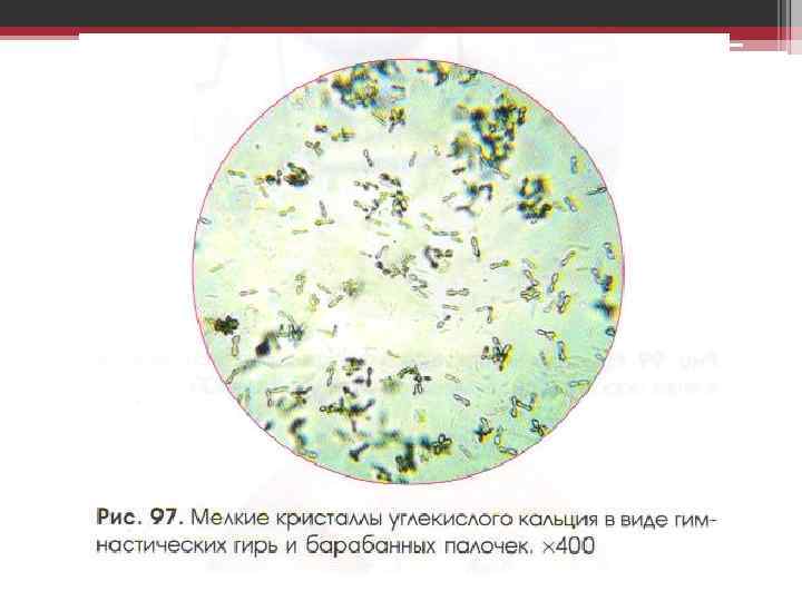 Организованный и неорганизованный осадок мочи презентация