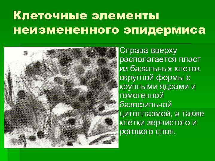 Клеточные элементы представлены. Кожные новообразования. Клетки Одланда. Возрастные новообразования на коже.