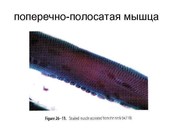 поперечно-полосатая мышца 