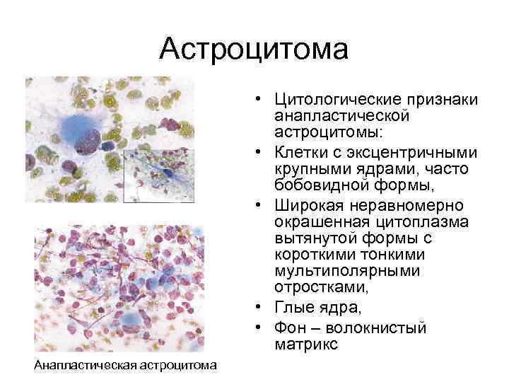 Цитологическая картина воспалительного процесса что это