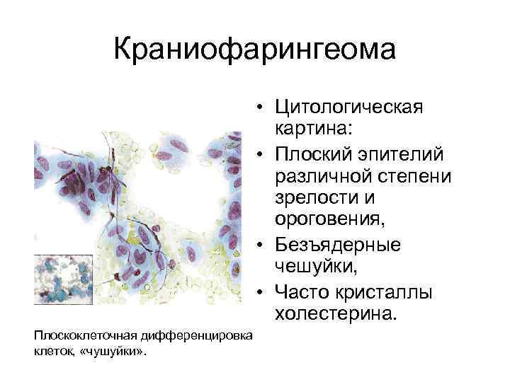 Цитологическая картина это