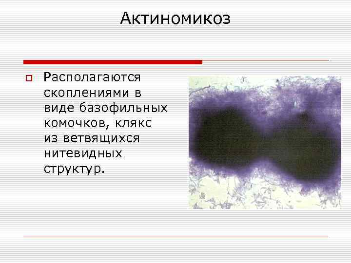 Актиномикоз o Располагаются скоплениями в виде базофильных комочков, клякс из ветвящихся нитевидных структур. 