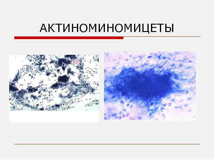 АКТИНОМИЦЕТЫ 