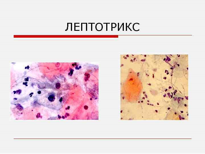 Коккобациллярная флора в мазке у женщин картинки