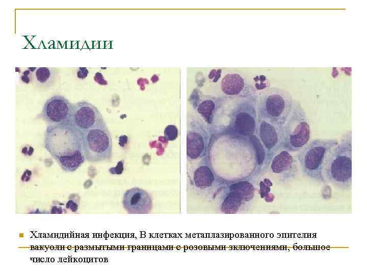Группы клеток метаплазированного