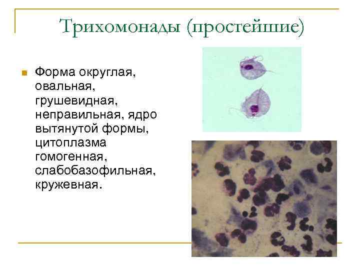 Группы клеток метаплазированного. Трихомонада цитоплазма. Клетки с ядрами неправильной формы. Ядерные клетки неправильной формы.