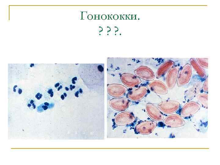 Гонококки. ? ? ? . 