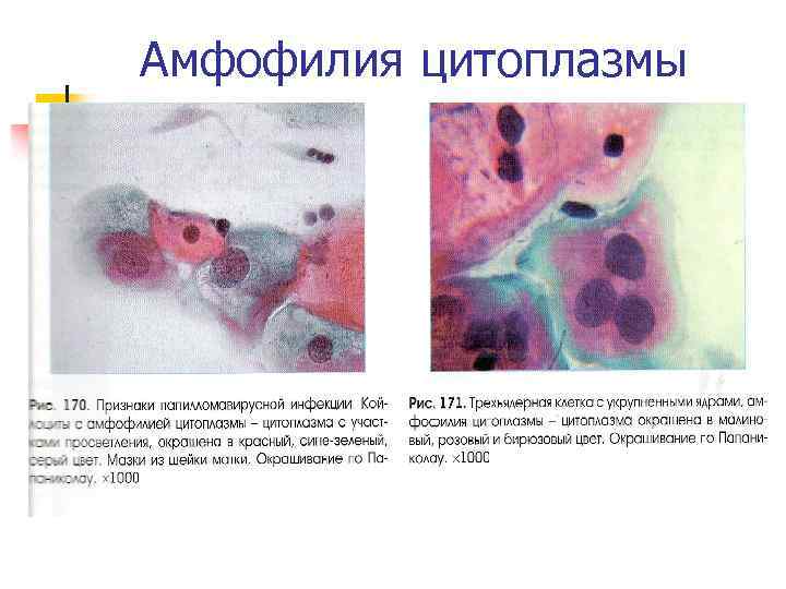 Амфофилия цитоплазмы 