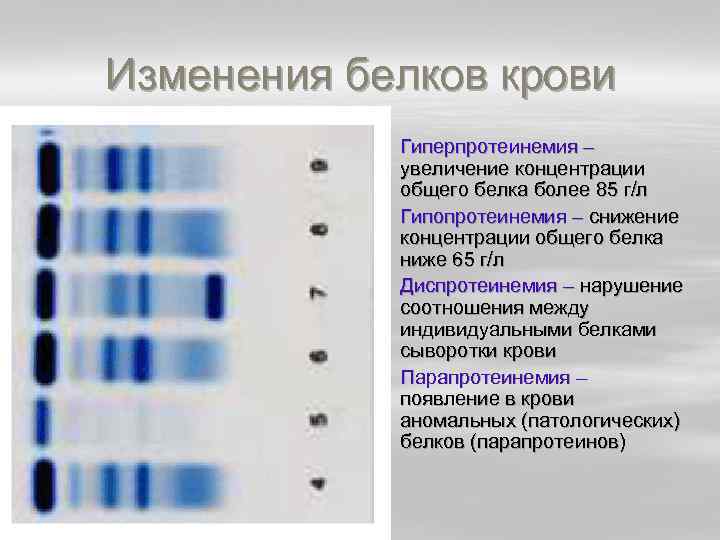 Диагностическое значение общего белка