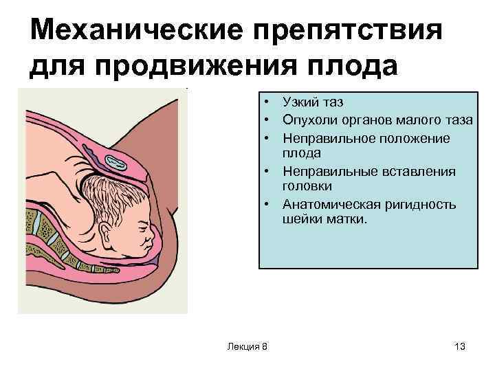 Аномалии родовой деятельности картинки