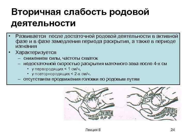 Слабость родовой деятельности презентация