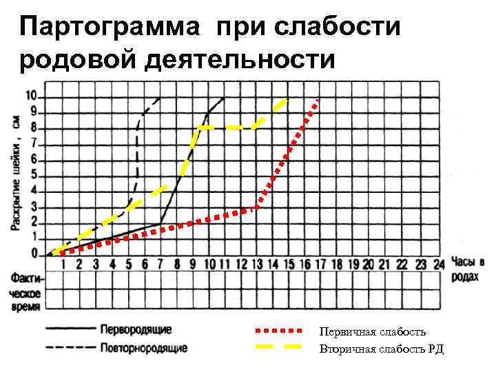 Партограмма в родах образец