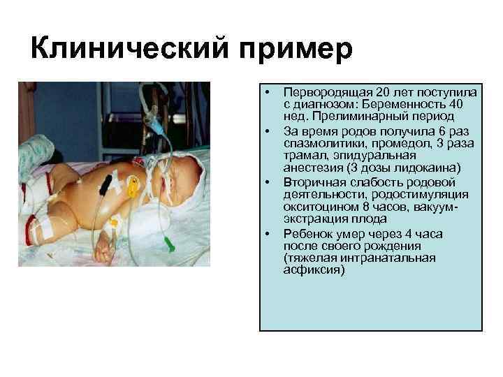 Клинический пример • • Первородящая 20 лет поступила с диагнозом: Беременность 40 нед. Прелиминарный