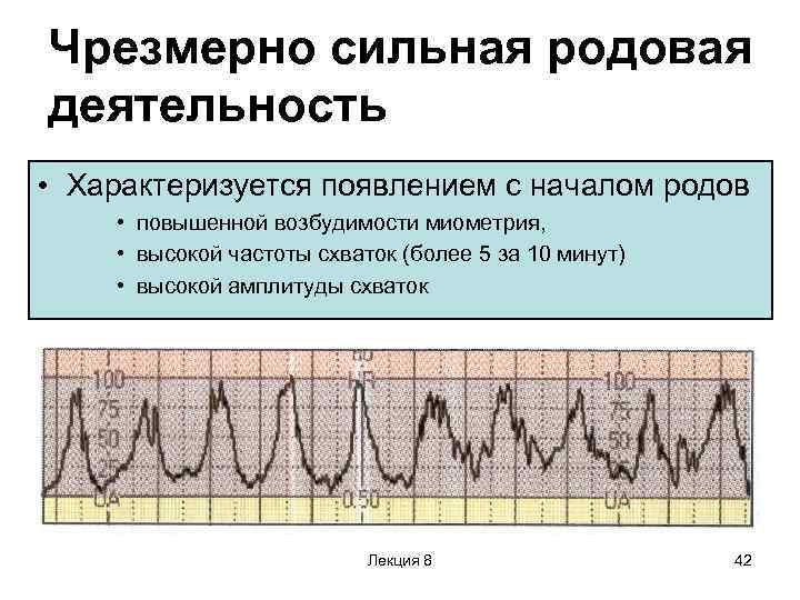 Чрезмерно сильная родовая деятельность