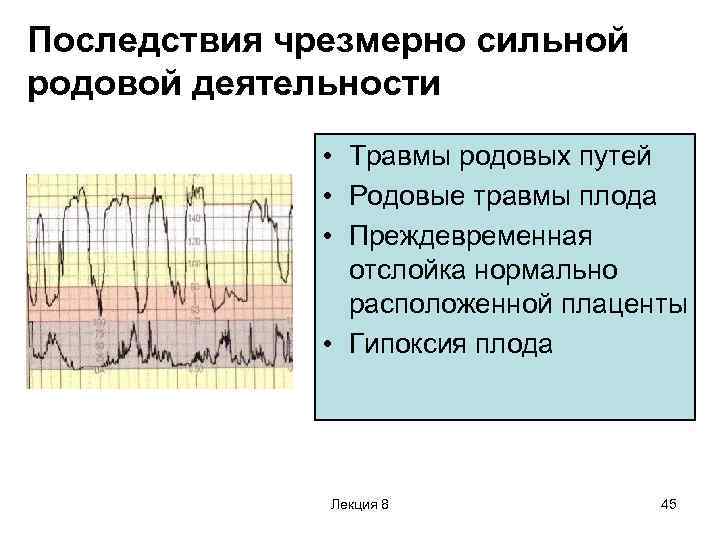 Чрезмерно сильная родовая деятельность