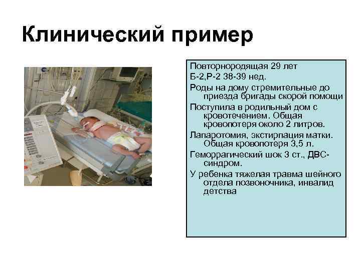 Клинический пример Повторнородящая 29 лет Б-2, Р-2 38 -39 нед. Роды на дому стремительные