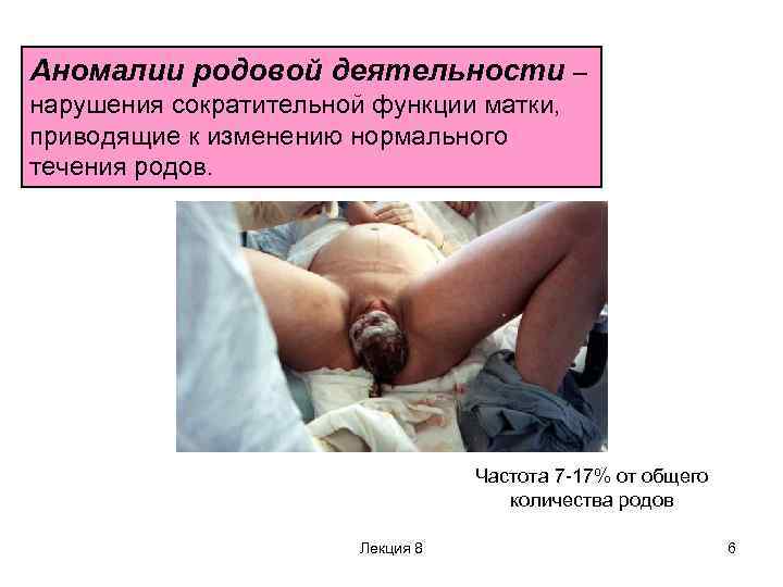 Аномалии родовой деятельности – нарушения сократительной функции матки, приводящие к изменению нормального течения родов.