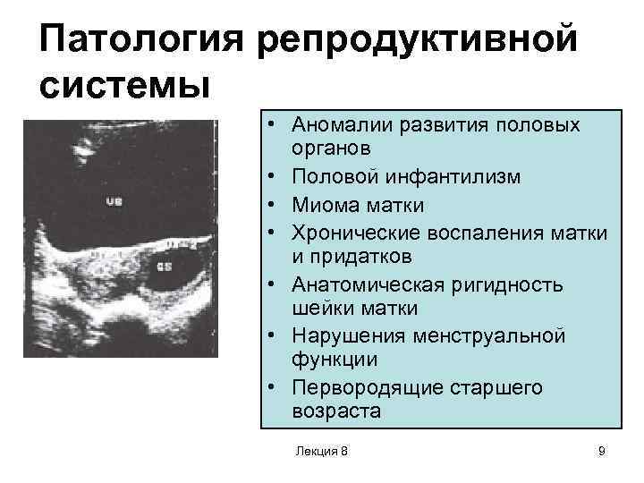 Формирования репродуктивных органов. Патология репродуктивной системы женщины. Пороки развития женской половой системы. Пороки развития репродуктивной системы женщины.