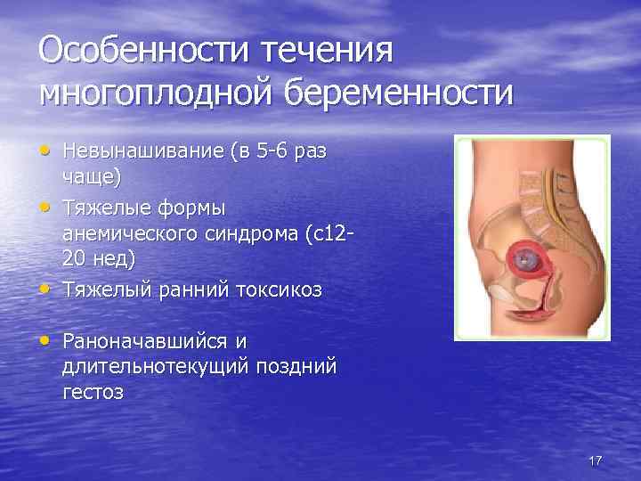 Особенности течения многоплодной беременности • Невынашивание (в 5 -6 раз • • чаще) Тяжелые