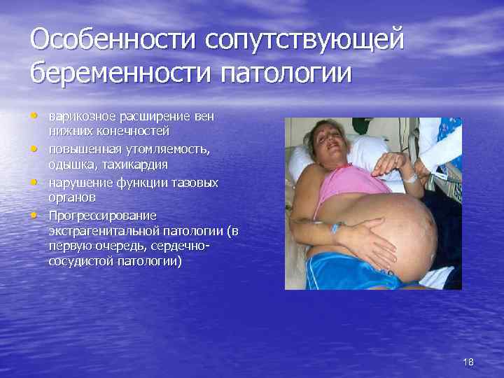 Особенности сопутствующей беременности патологии • варикозное расширение вен • • • нижних конечностей повышенная
