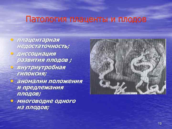Патология плаценты и плодов • плацентарная • • недостаточность; диссоциация развития плодов ; внутриутробная