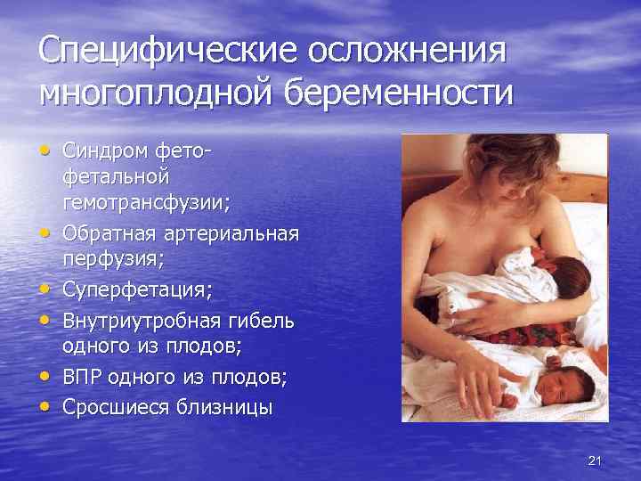 Специфические осложнения многоплодной беременности • Синдром фето • • • фетальной гемотрансфузии; Обратная артериальная