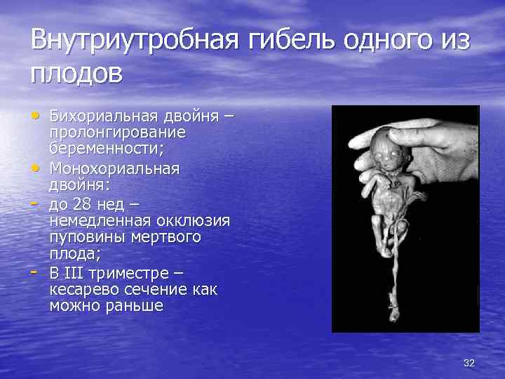 Внутриутробная гибель одного из плодов • Бихориальная двойня – • - пролонгирование беременности; Монохориальная