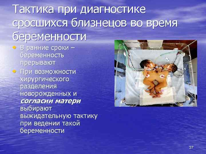 Тактика при диагностике сросшихся близнецов во время беременности • В ранние сроки – •