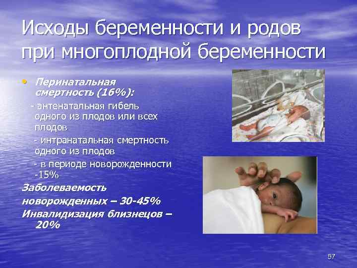 Исходы беременности и родов при многоплодной беременности • Перинатальная смертность (16%): - антенатальная гибель