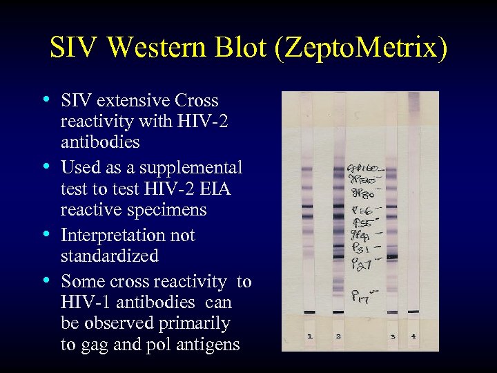 SIV Western Blot (Zepto. Metrix) • SIV extensive Cross reactivity with HIV-2 antibodies •