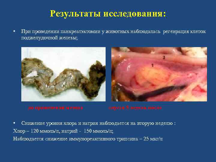 Результаты исследования: • При проведении панкреатэктомии у животных наблюдалась регенрация клеток поджелудочной железы; до