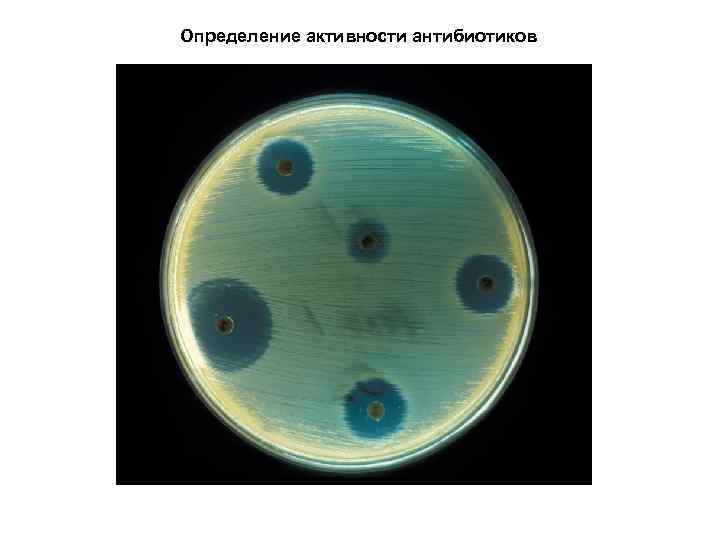 Определение активности антибиотиков 