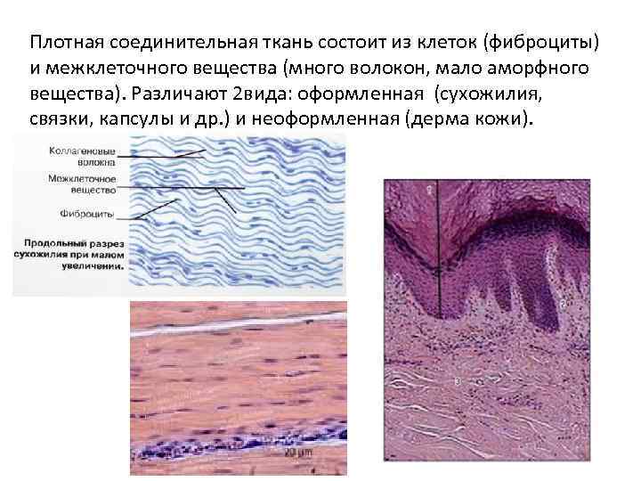 Плотная соединительная ткань состоит из клеток (фиброциты) и межклеточного вещества (много волокон, мало аморфного