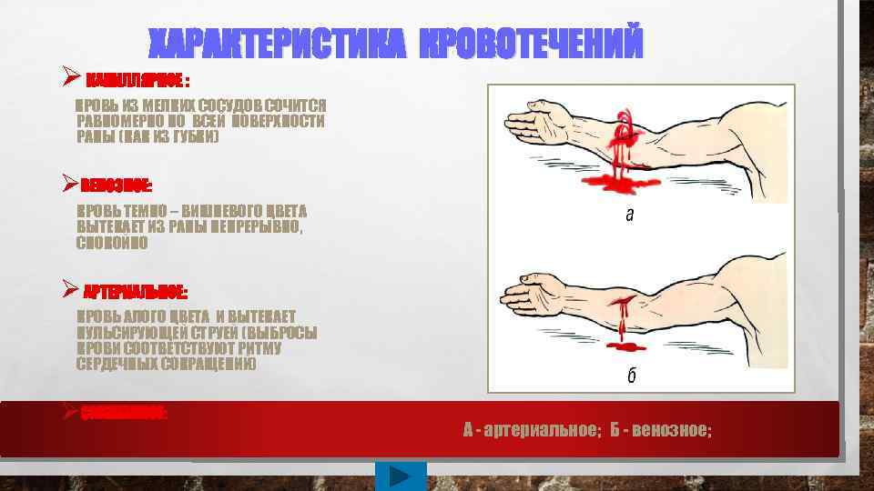 ХАРАКТЕРИСТИКА КРОВОТЕЧЕНИЙ Ø КАПИЛЛЯРНОЕ : КРОВЬ ИЗ МЕЛКИХ СОСУДОВ СОЧИТСЯ РАВНОМЕРНО ПО ВСЕЙ ПОВЕРХНОСТИ
