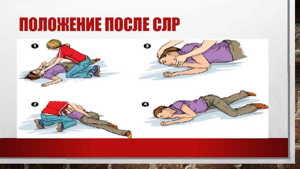 ПОЛОЖЕНИЕ ПОСЛЕ СЛР 