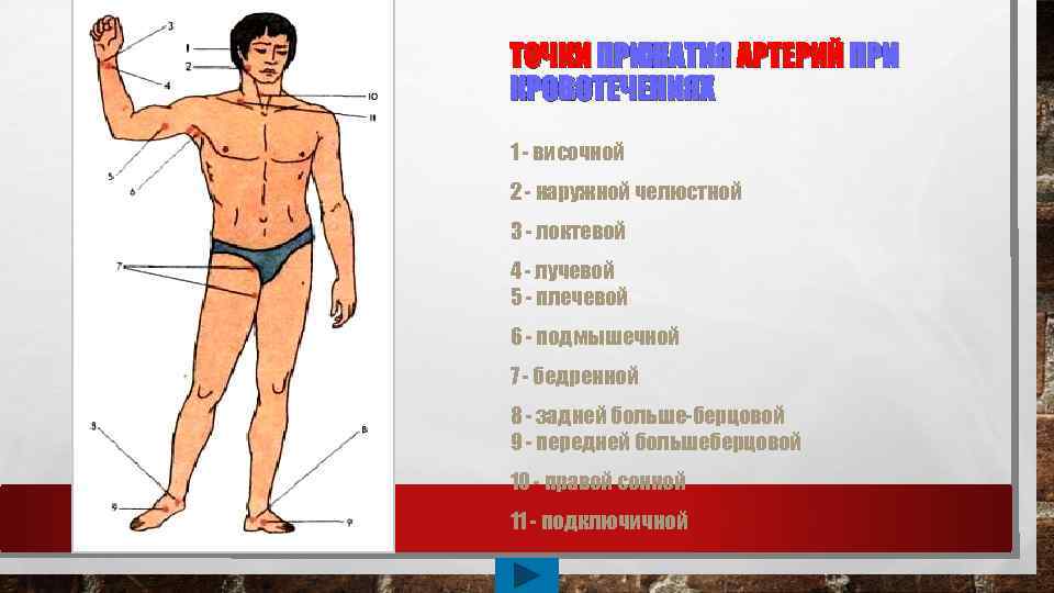 ТОЧКИ ПРИЖАТИЯ АРТЕРИЙ ПРИ КРОВОТЕЧЕНИЯХ 1 - височной 2 - наружной челюстной 3 -
