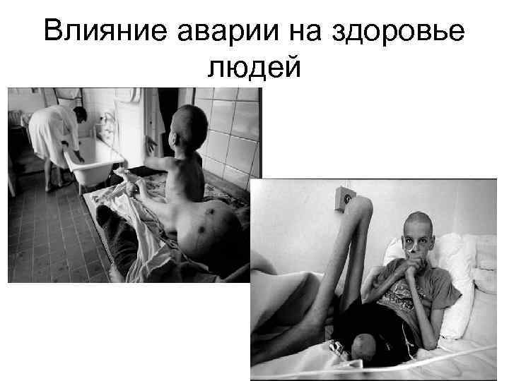 Влияние аварии на здоровье людей 